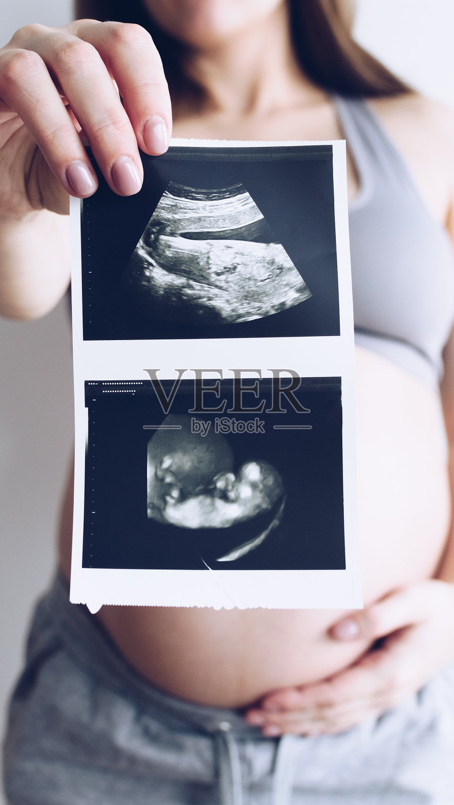 孕妇用超声波扫描婴儿照片摄影图片