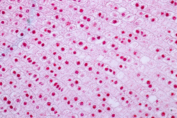 洋葱根尖有丝分裂细胞的显微镜观察图片